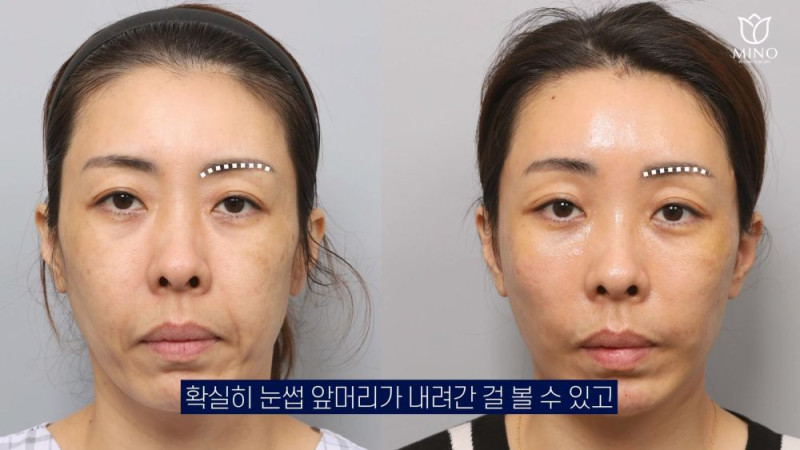 c92b5adf5dfbcc96baff44b6c137f72e_1746074450_4963.jpg