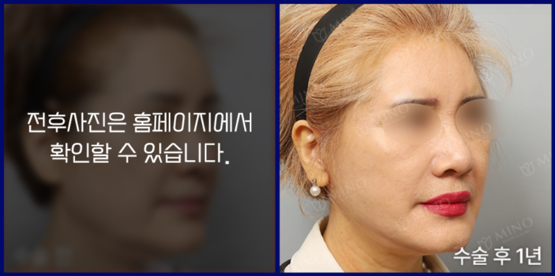 2279f9768d622305d1993bd397deb54a_1766675096_2249.png