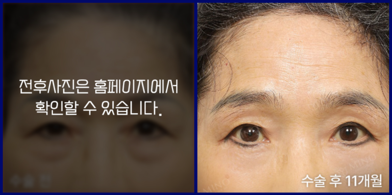 37388eaae94cfc3bb61d585175a3910b_1768313379_3519.png
